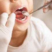 ¿Cómo se forman las caries y cómo evitarlo?