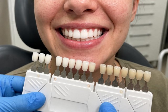 Carillas dentales sin desgaste en disilicato o composite en Vigo - Imagen 1
