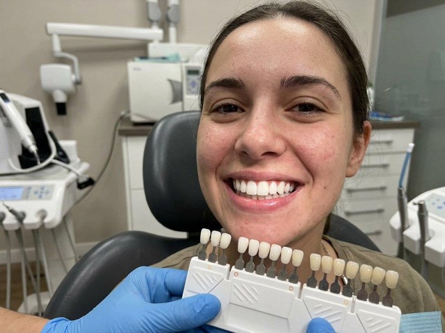 Carillas dentales sin desgaste en disilicato o composite en Vigo