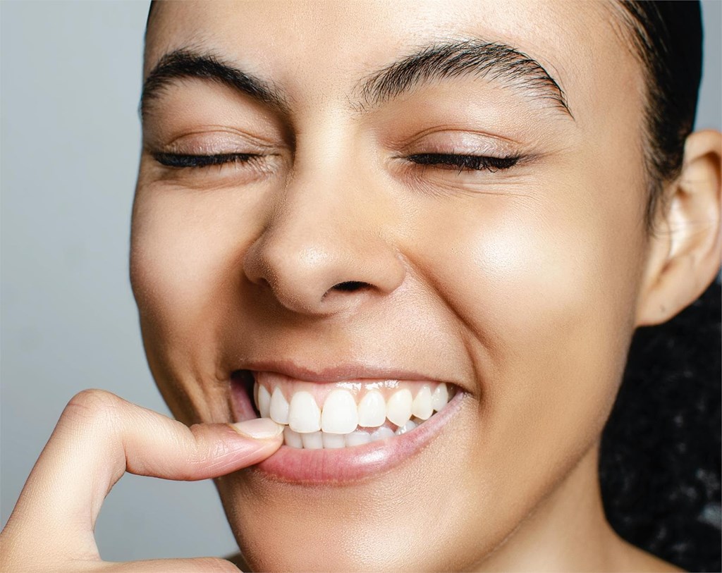 ¡Carillas dentales sin desgaste! Una sonrisa perfecta con Titanium Clínica Dental & Estética