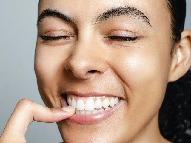 ¡Carillas dentales sin desgaste! Una sonrisa perfecta con Titanium Clínica Dental & Estética