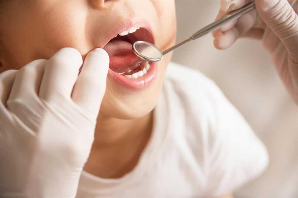 ¿Cómo se forman las caries y cómo evitarlo?