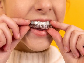 ¿Cuáles son las ventajas de la ortodoncia invisible?