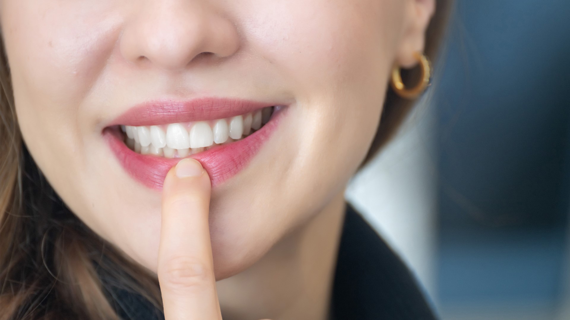 Especialistas en implantes dentales en Vigo