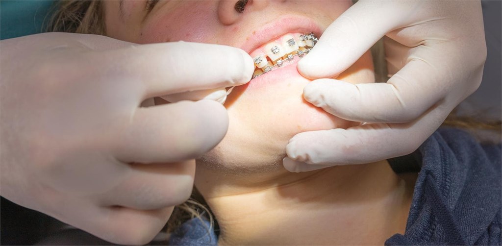 Especialistas en ortodoncia en Vigo