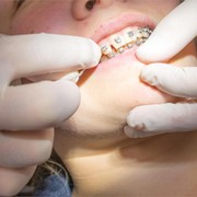 Especialistas en ortodoncia en Vigo