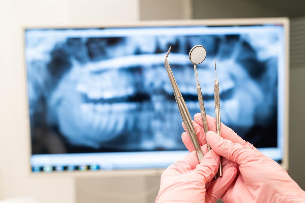 Expertos en implantes zigomáticos en Vigo