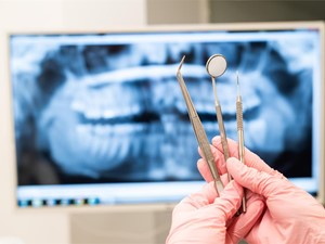 Expertos en implantes zigomáticos en Vigo