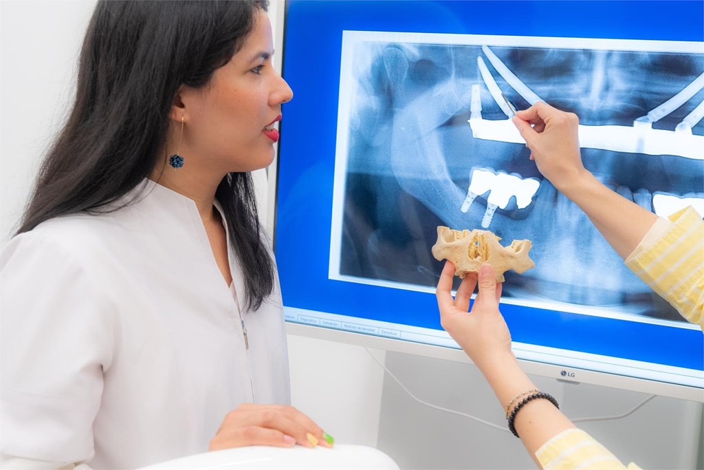 ¿Fumar afecta al éxito de los implantes cigomáticos? Lo que debes saber