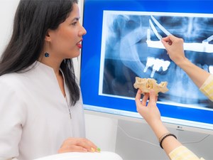 ¿Fumar afecta al éxito de los implantes cigomáticos? Lo que debes saber