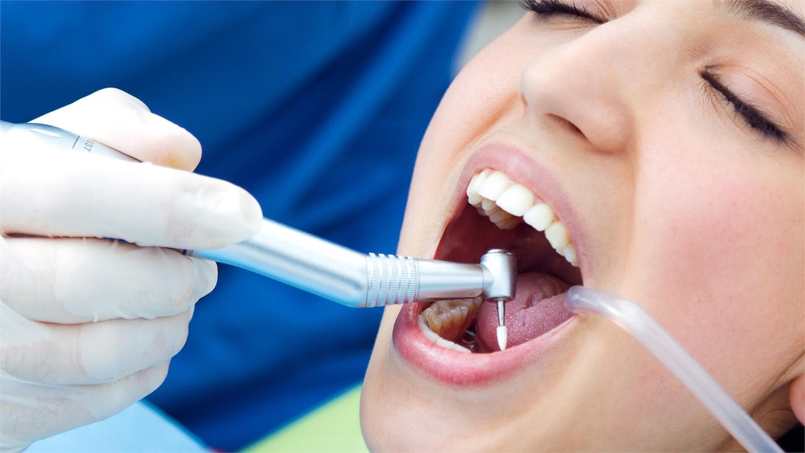 Gingivitis o enfermedad de las encías, ¿qué lo causan? - Imagen 1