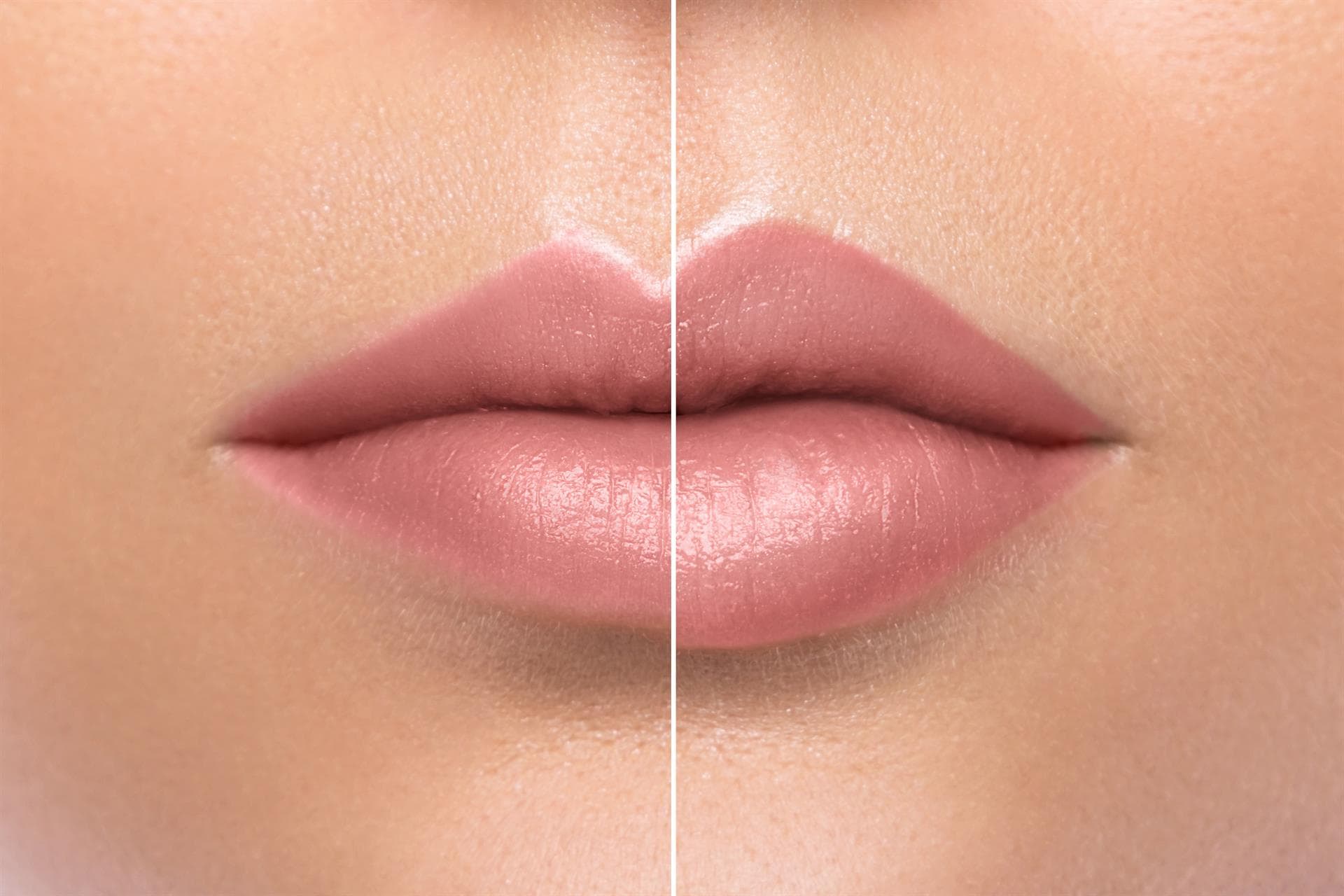 Hidratación de labios en Vigo