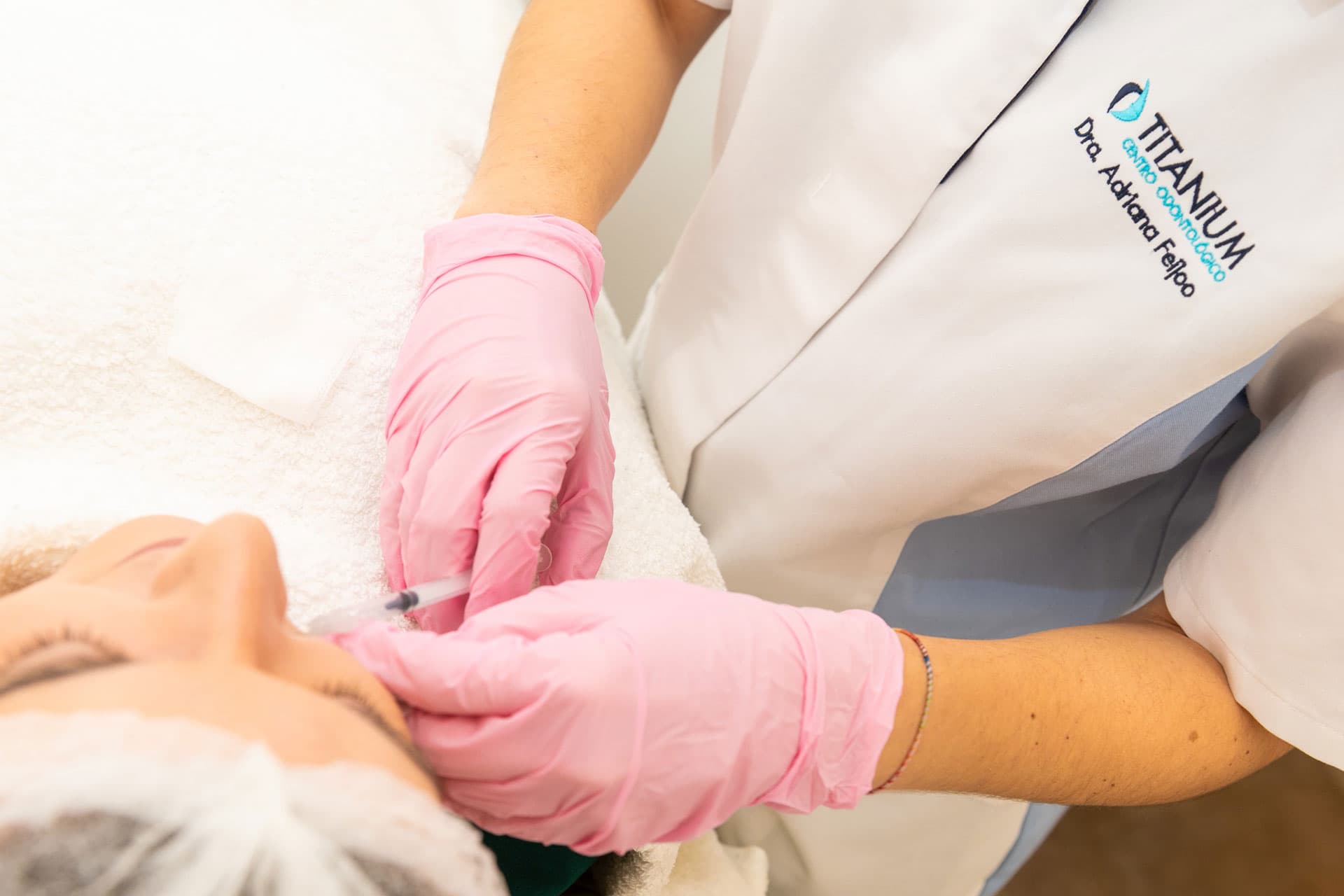 Perfilado de labios en Vigo