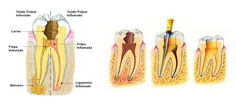 Tratamientos de cirugía oral en Vigo