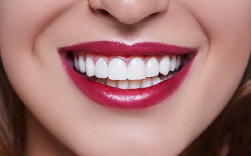 Estética dental en Vigo