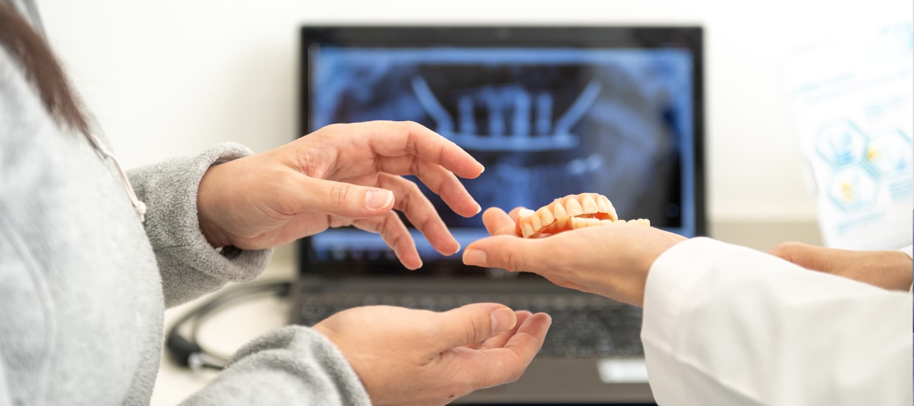 Ver promoción para implantes dentales en Vigo