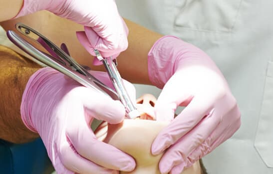 Infecciones bucales en Vigo
