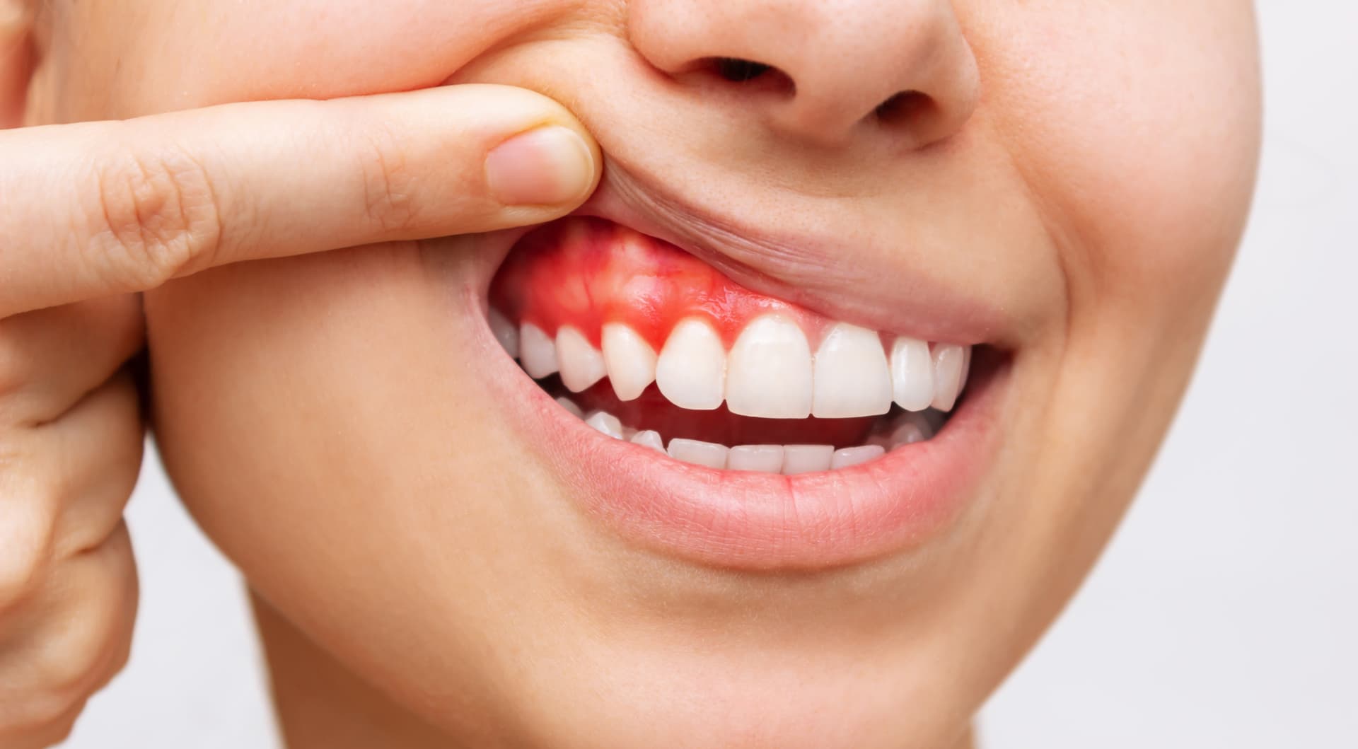  Dentistas especializados en periodoncia