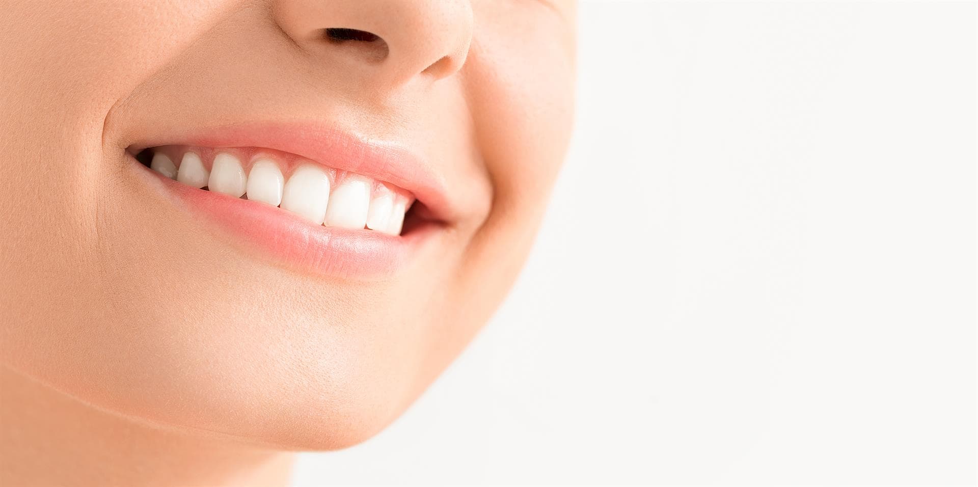 ¿Cómo cuidar las carillas dentales?