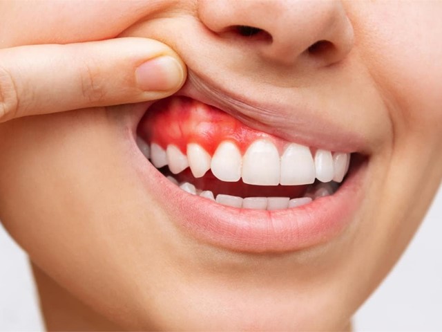 La importancia de la detección temprana en la periodoncia