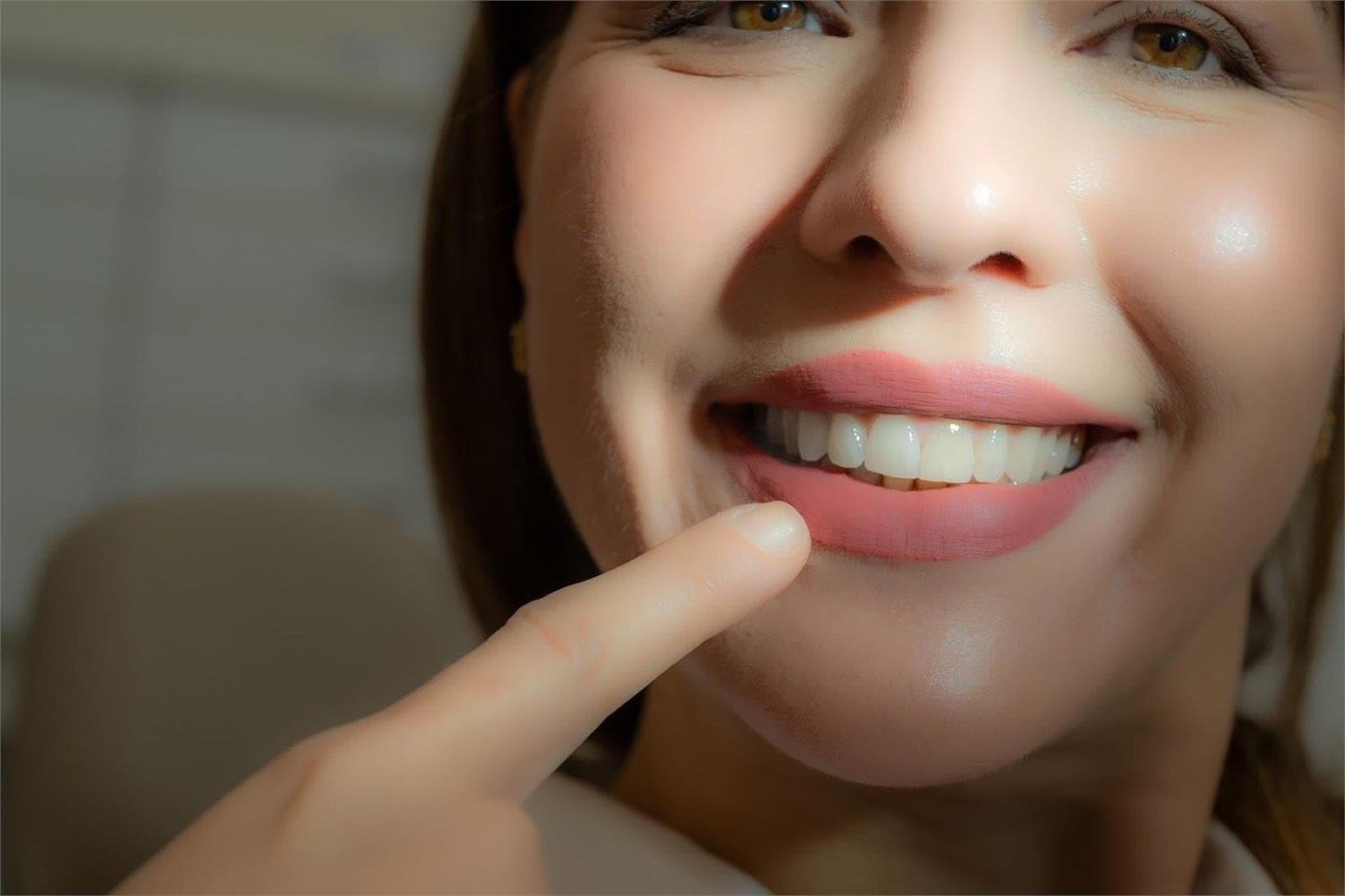 Mitos comunes sobre las carillas dentales