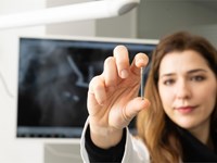 ¿Para quién está indicado el sistema de implantes dentales All on 4?