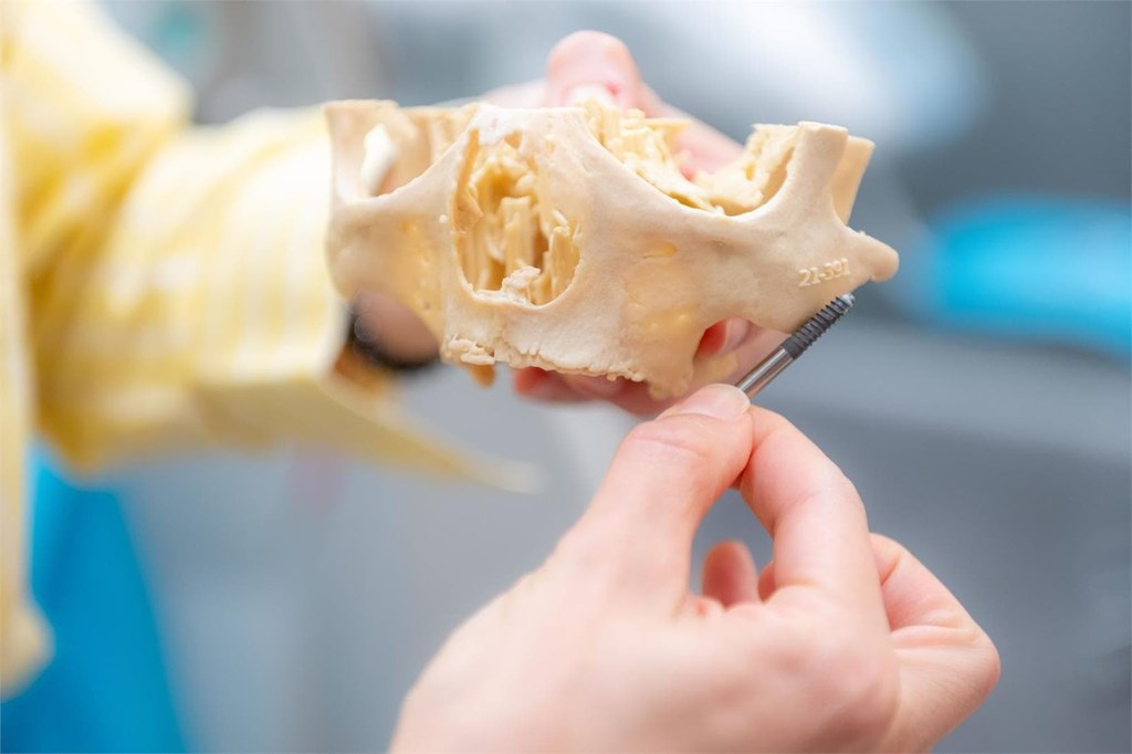 ¿Puedo llevar implantes si llevo años sin dientes?