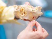 ¿Puedo llevar implantes si llevo años sin dientes?