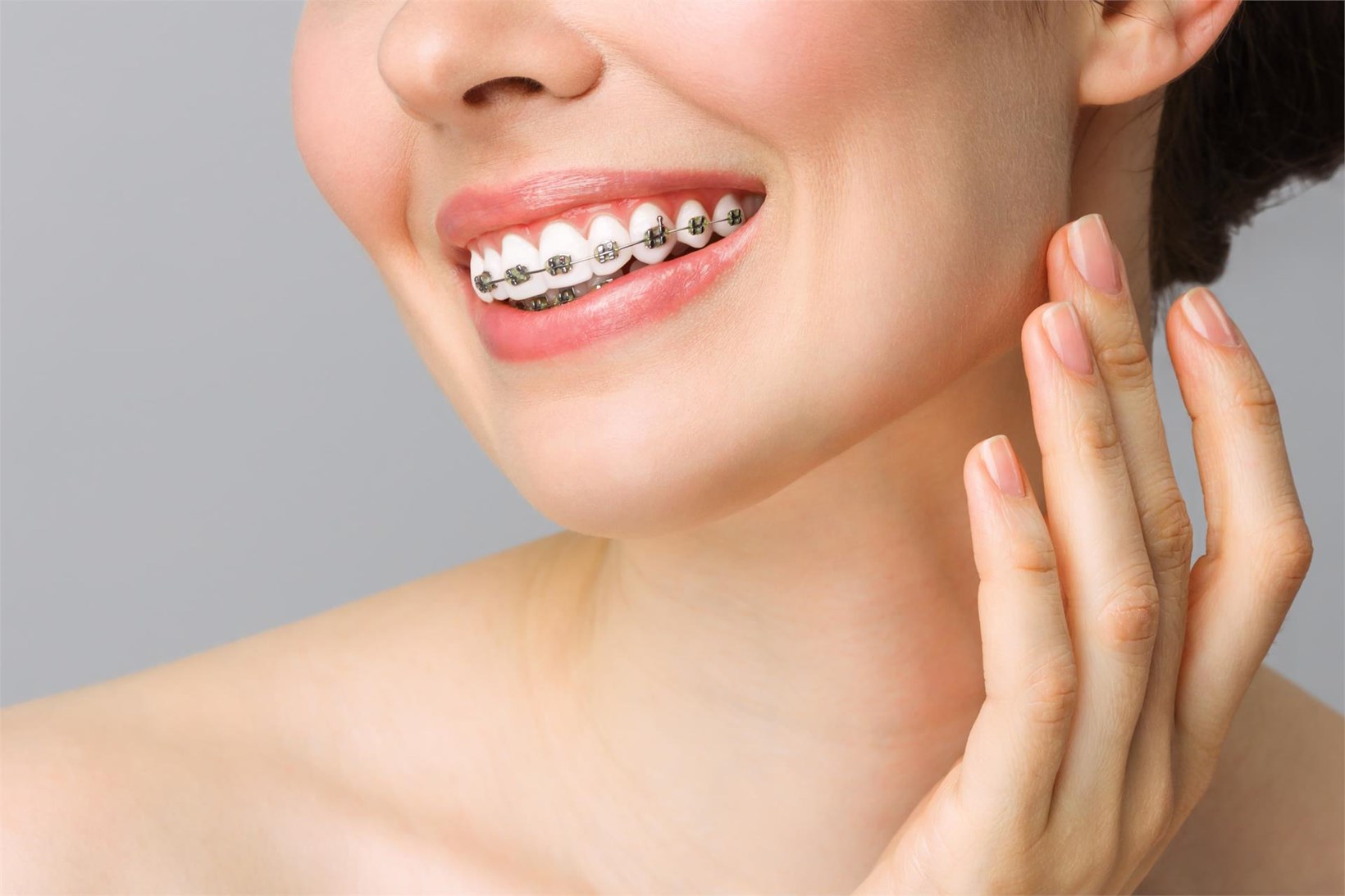 ¿Qué sistema de ortodoncia es el más efectivo?