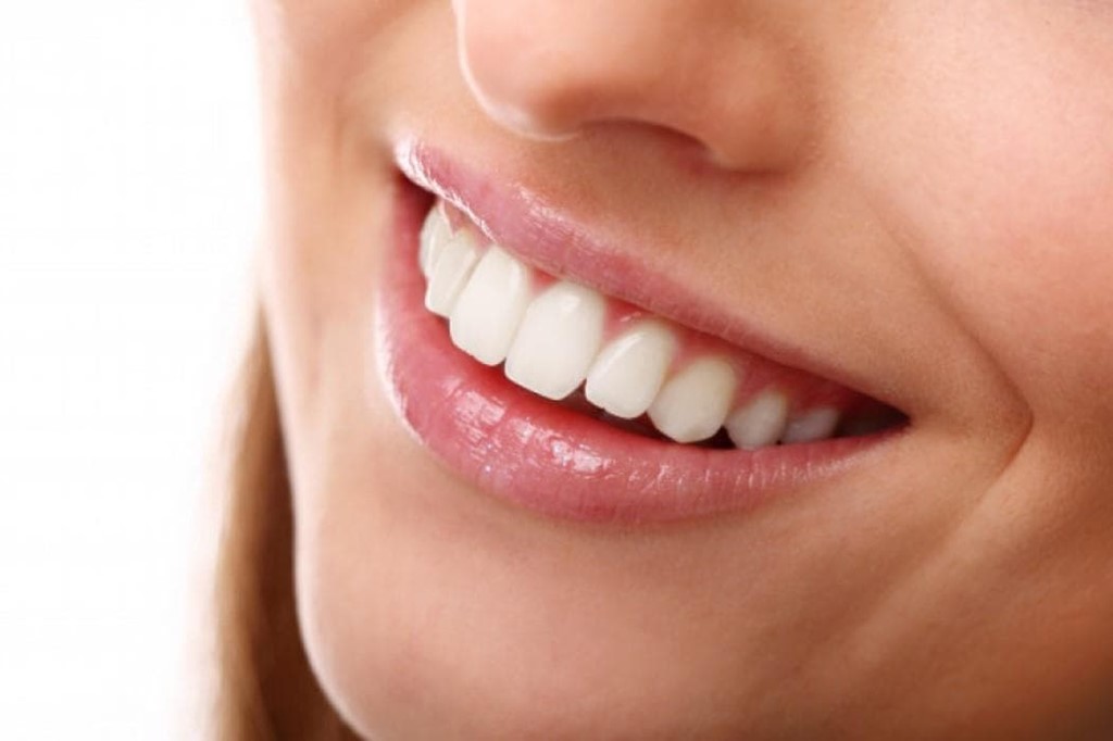 https://www.dentaltitanium.com/sabe-como-se-colocan-las-carillas-dentales-sin-desgaste_img45629t1.jpg