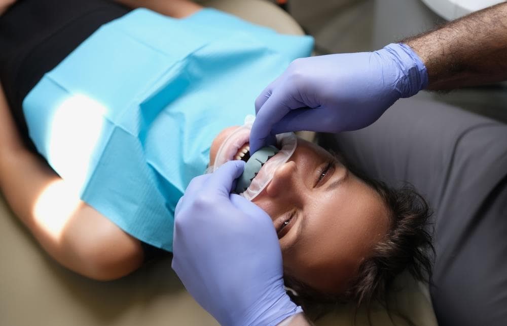 Tipos de carillas dentales
