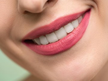 Todos los beneficios de colocarte carillas dentales sin desgaste en Vigo	